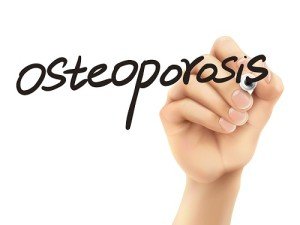 Osteoporosis Facts